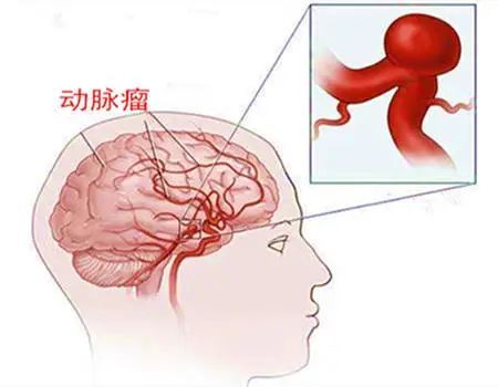 圖文圖片