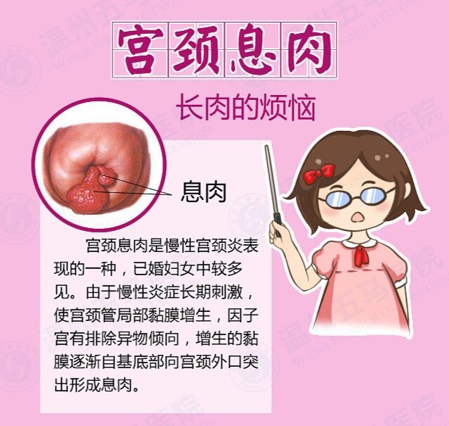 圖文圖片