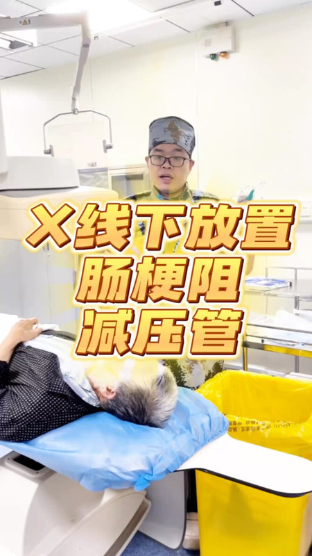 肠梗阻不开刀的利器-肠梗阻减压管