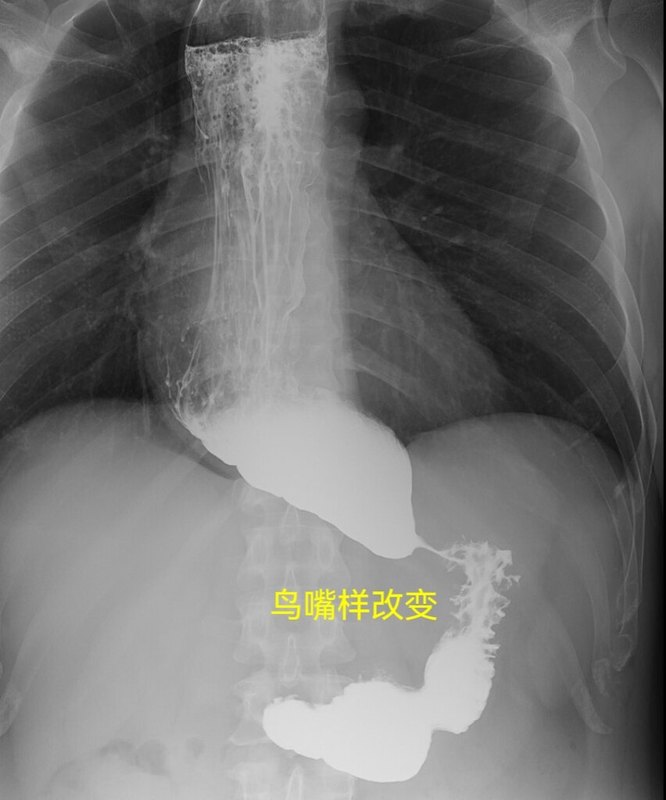 圖文圖片