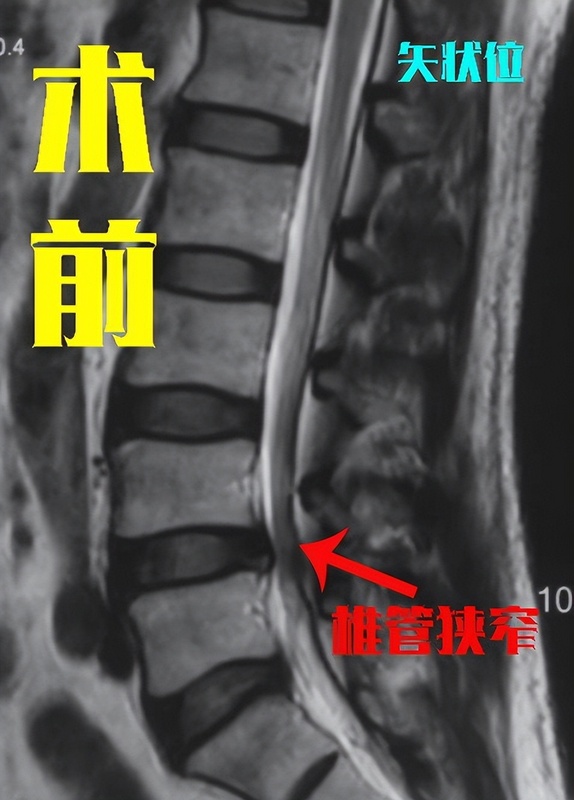 圖文圖片