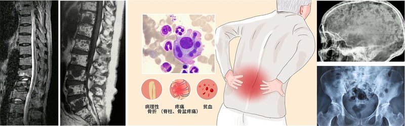 圖文圖片