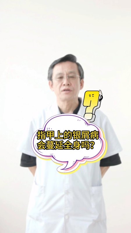 視頻封面