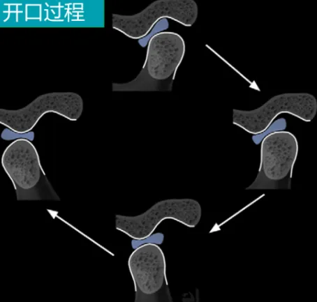 图文图片