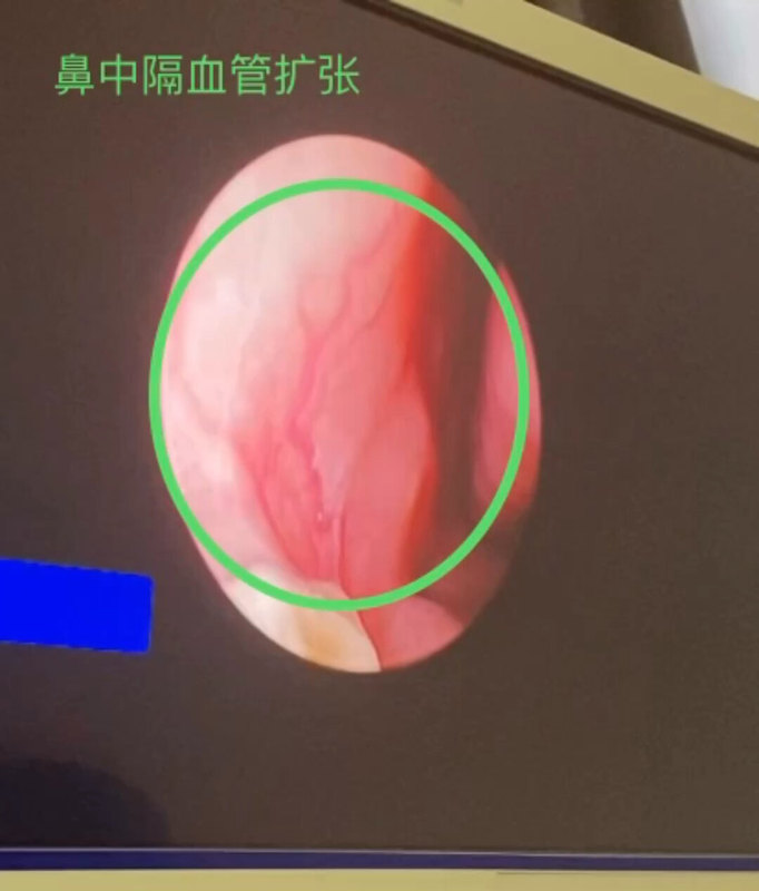 視頻封面