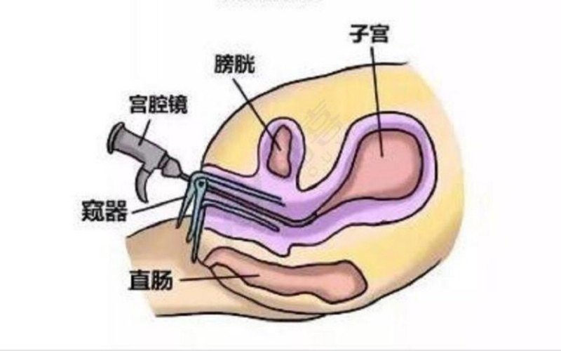 圖文圖片