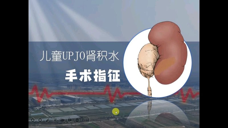 視頻封面
