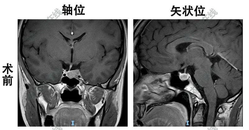 圖文圖片
