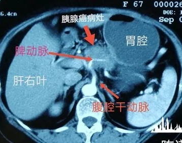 圖文圖片