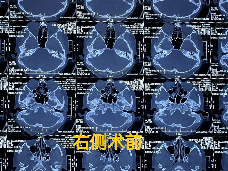 圖文圖片
