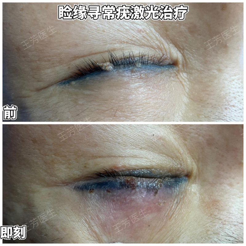 圖文圖片