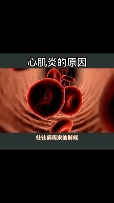 視頻封面