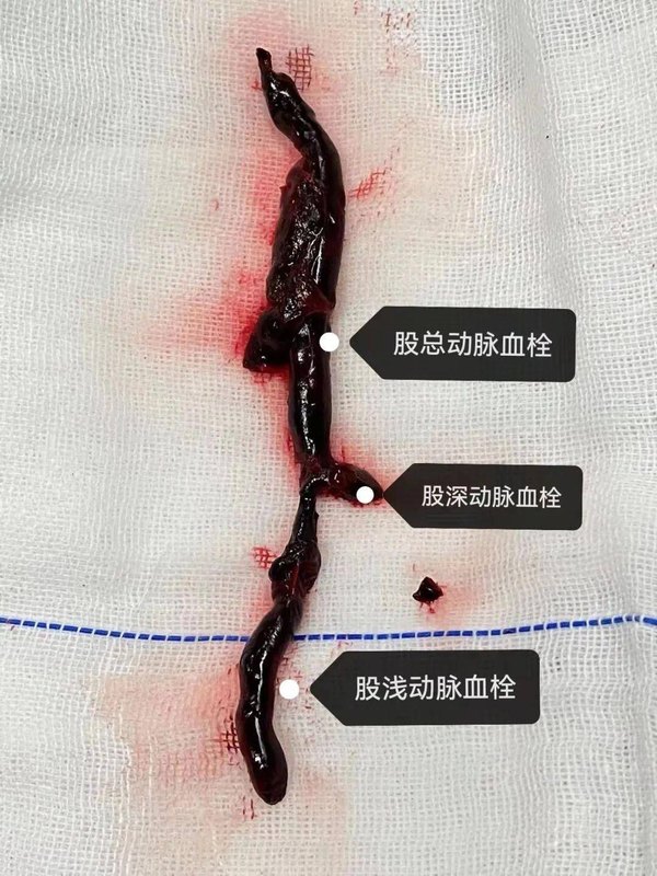 圖文圖片