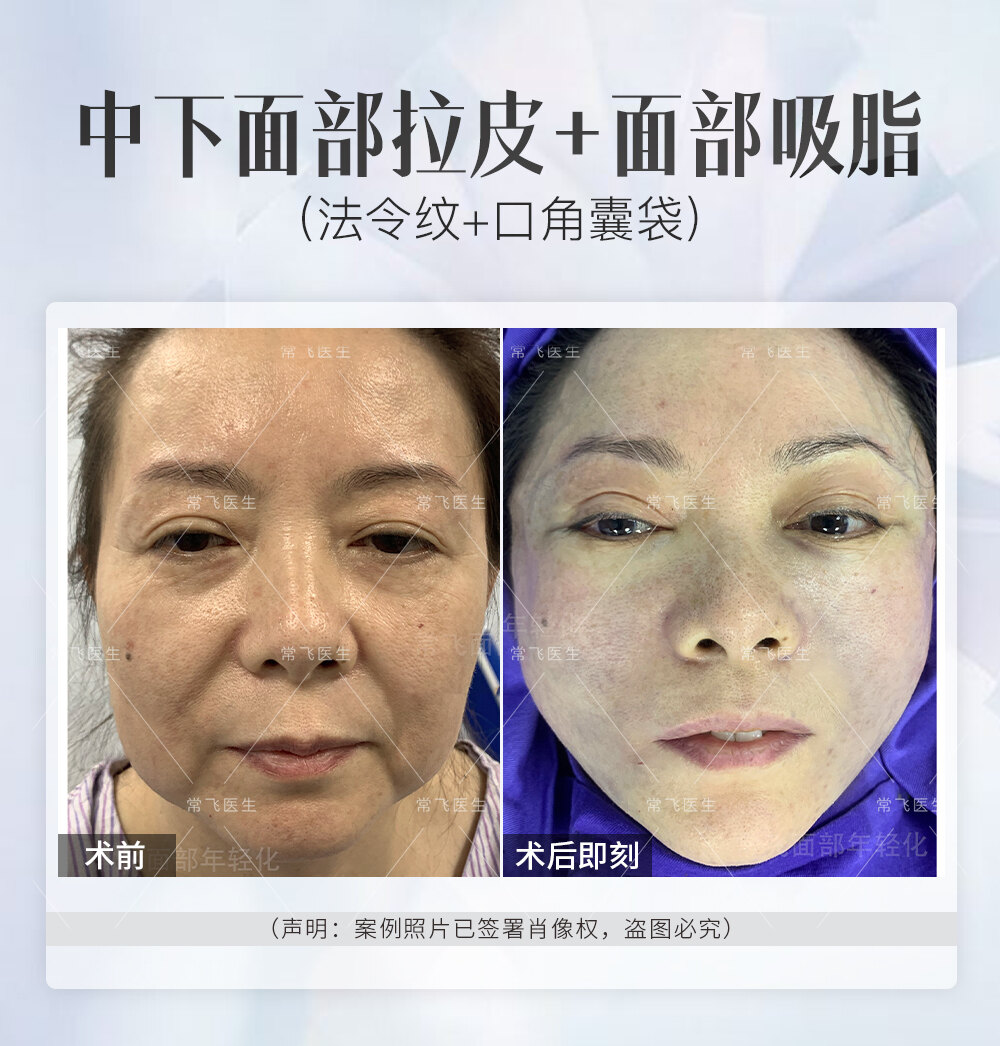 圖文圖片