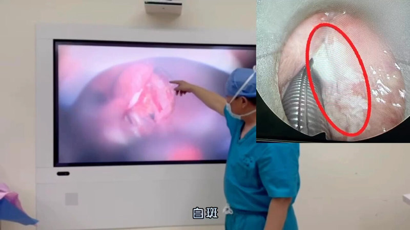 視頻封面