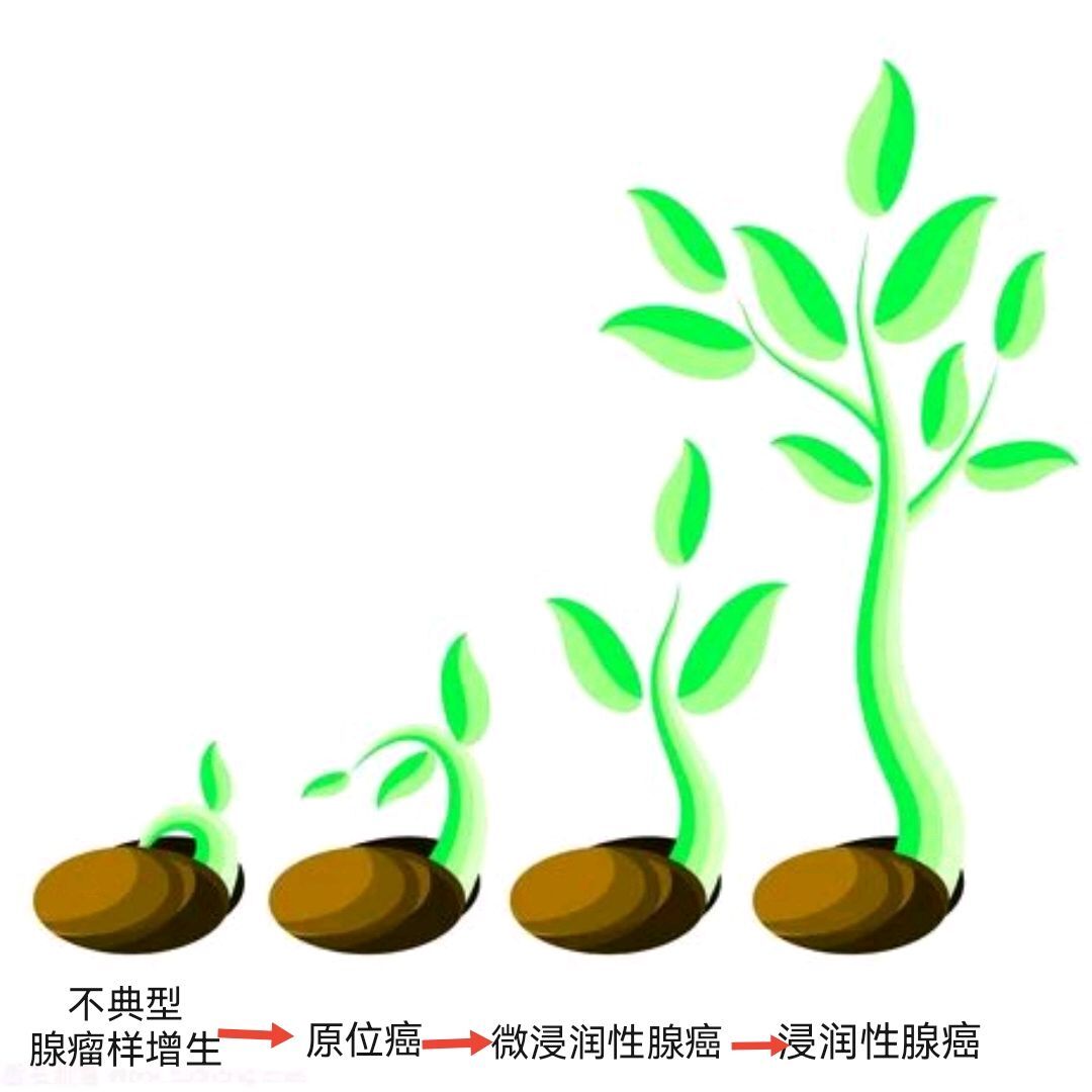 圖文圖片