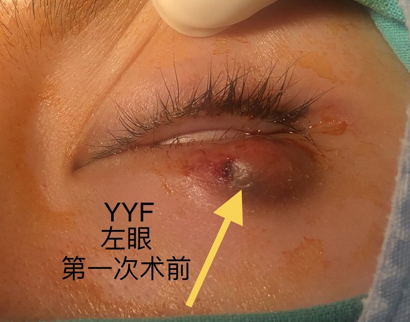圖文圖片