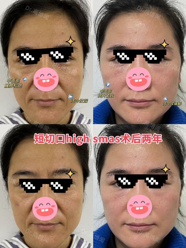 圖文圖片