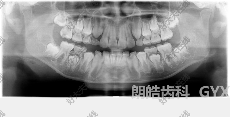 圖文圖片