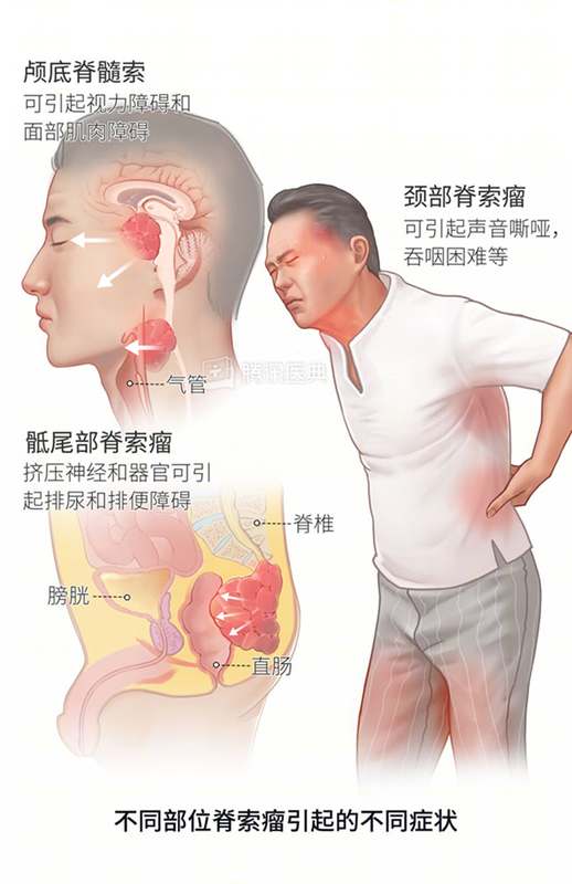 圖文圖片