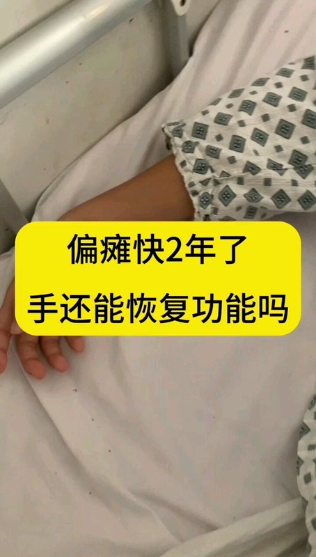 偏瘫快2年了手功能应该这么康复