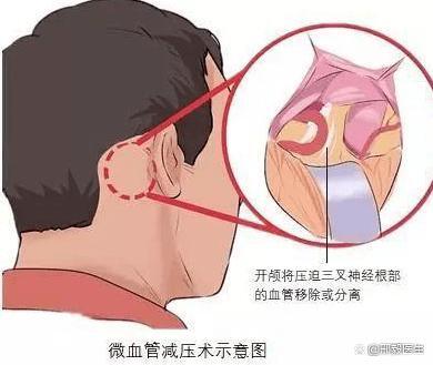 圖文圖片