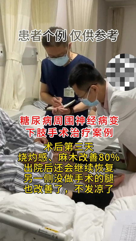 糖尿病下肢周围神经病变手术案例，烧灼感、麻木、发凉、电击感、蚁走感等表现