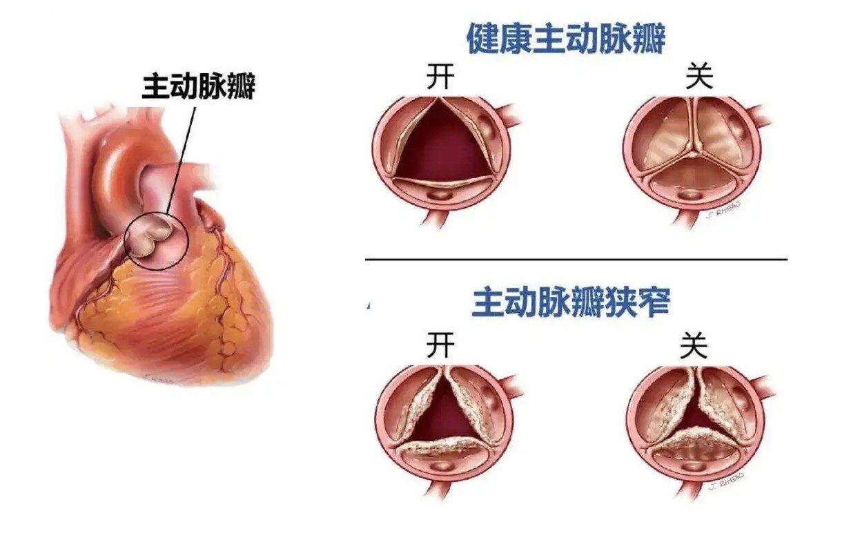 圖文圖片
