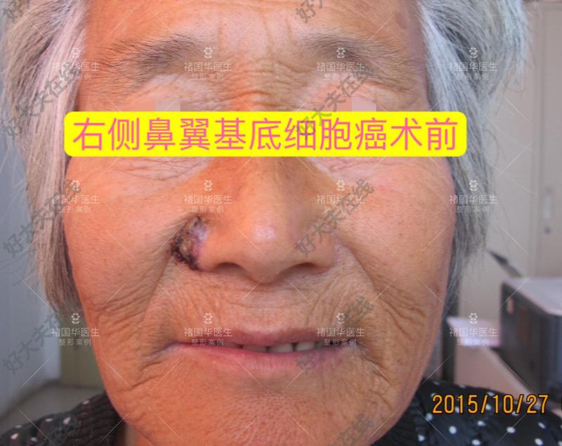 圖文圖片