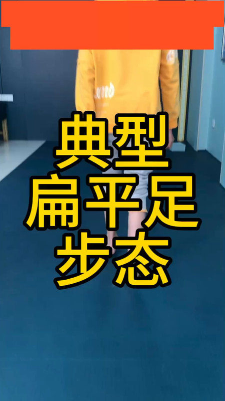 典型扁平足患者的步态：后足外翻，前足外展，足踝内侧凸出、足踝内侧负重。