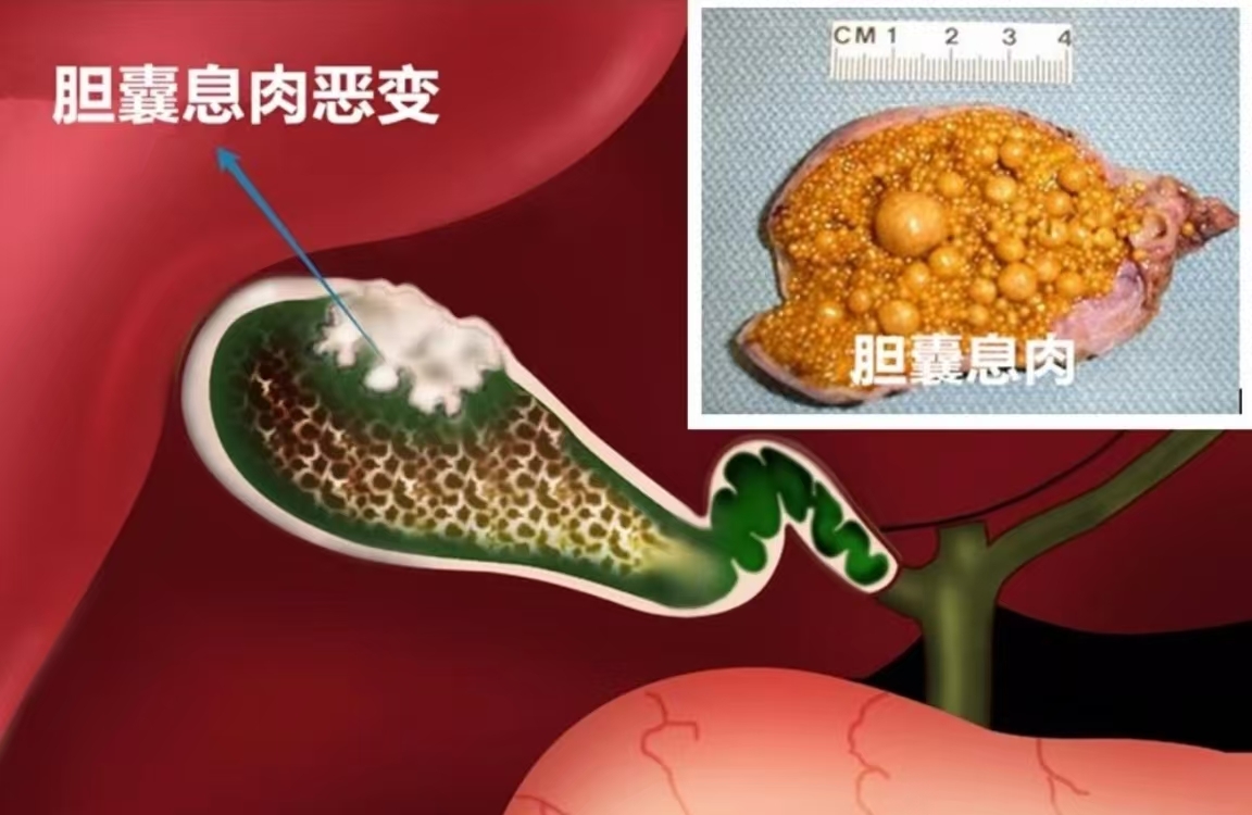 圖文圖片