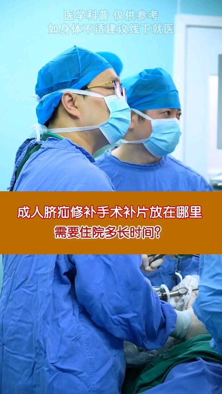 成人脐疝修补手术补片放在哪里，需要住院多长时间＃成人脐疝 ＃微创手术 ＃日间手术
