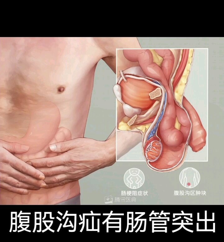 視頻封面