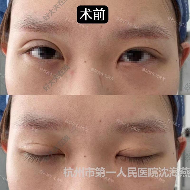 圖文圖片