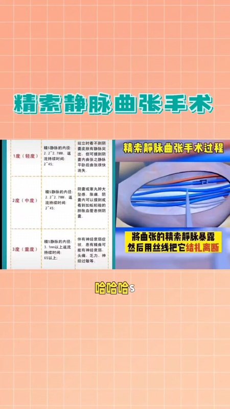 視頻封面
