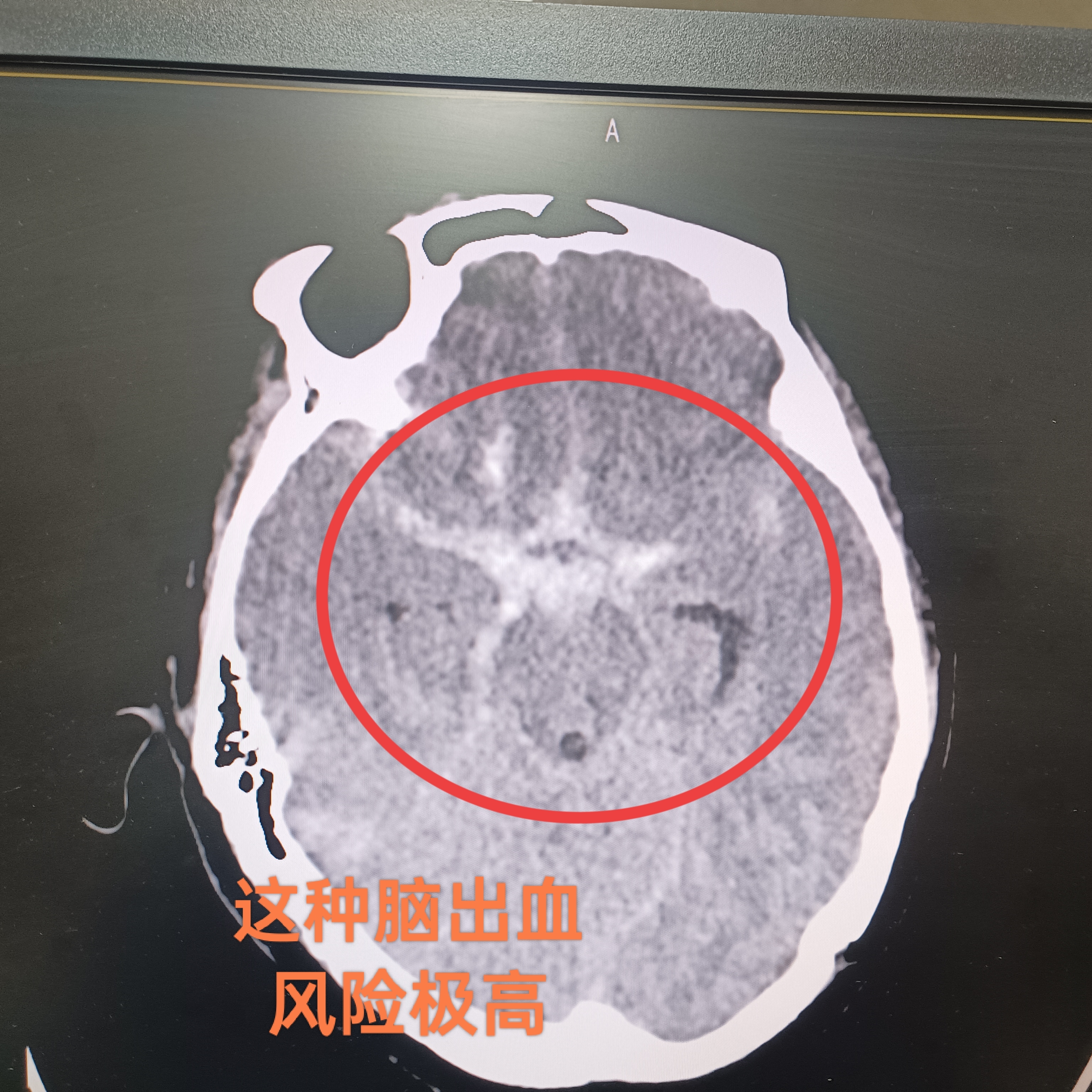 圖文圖片
