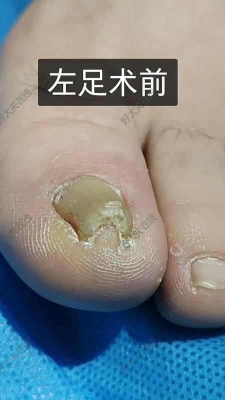 圖文圖片