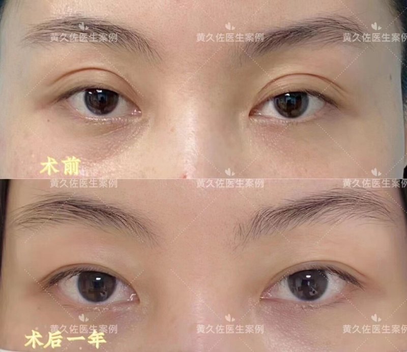 圖文圖片