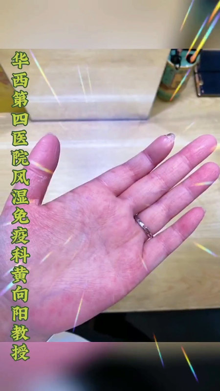 硬皮病指尖缺血性坏死、坏疽、变黑治疗过程