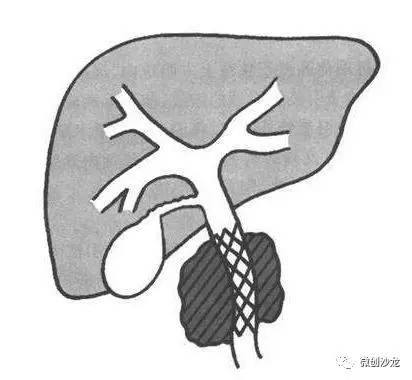 圖文圖片