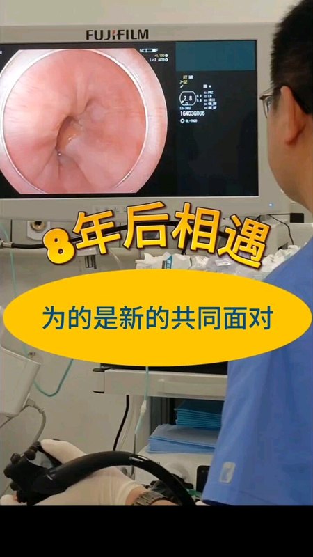 8年前的食管早癌ESD患者再度复发，精细胃镜食管早癌筛查病魔现身 ＃消化内科周益峰医生