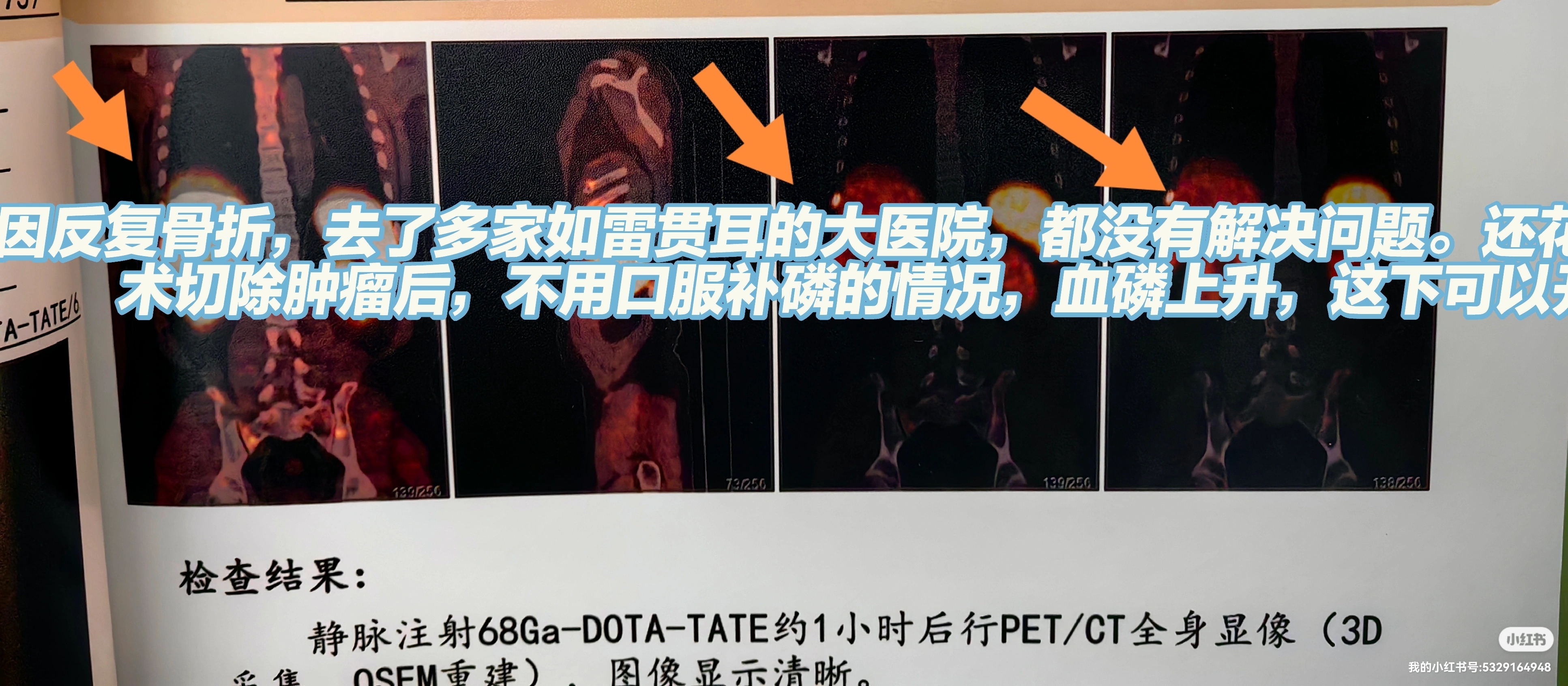 圖文圖片