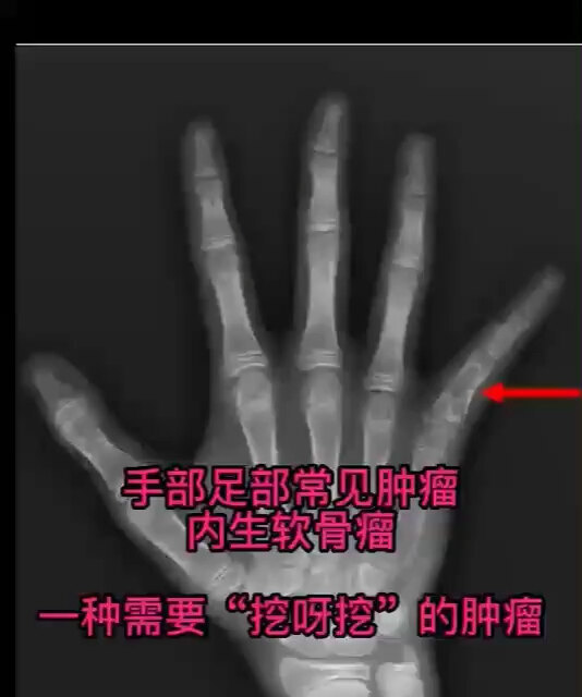視頻封面