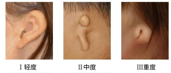 圖文圖片