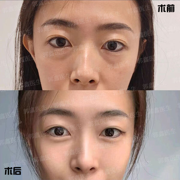 圖文圖片