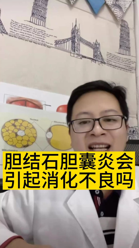 胆结石胆囊炎会引起消化不良吗？＃医学科普 ＃胆结石 ＃胆囊炎