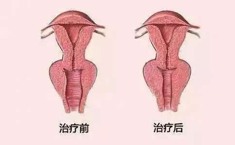 圖文圖片
