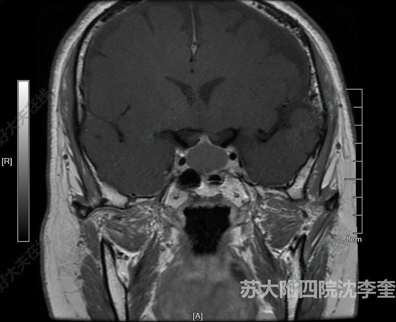 圖文圖片