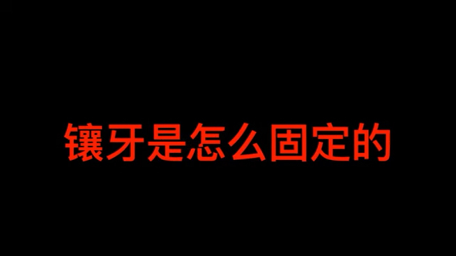 镶牙是怎么固定的
