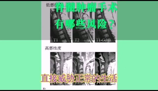 視頻封面
